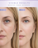 Clairvex Instant Lift Eye Gel