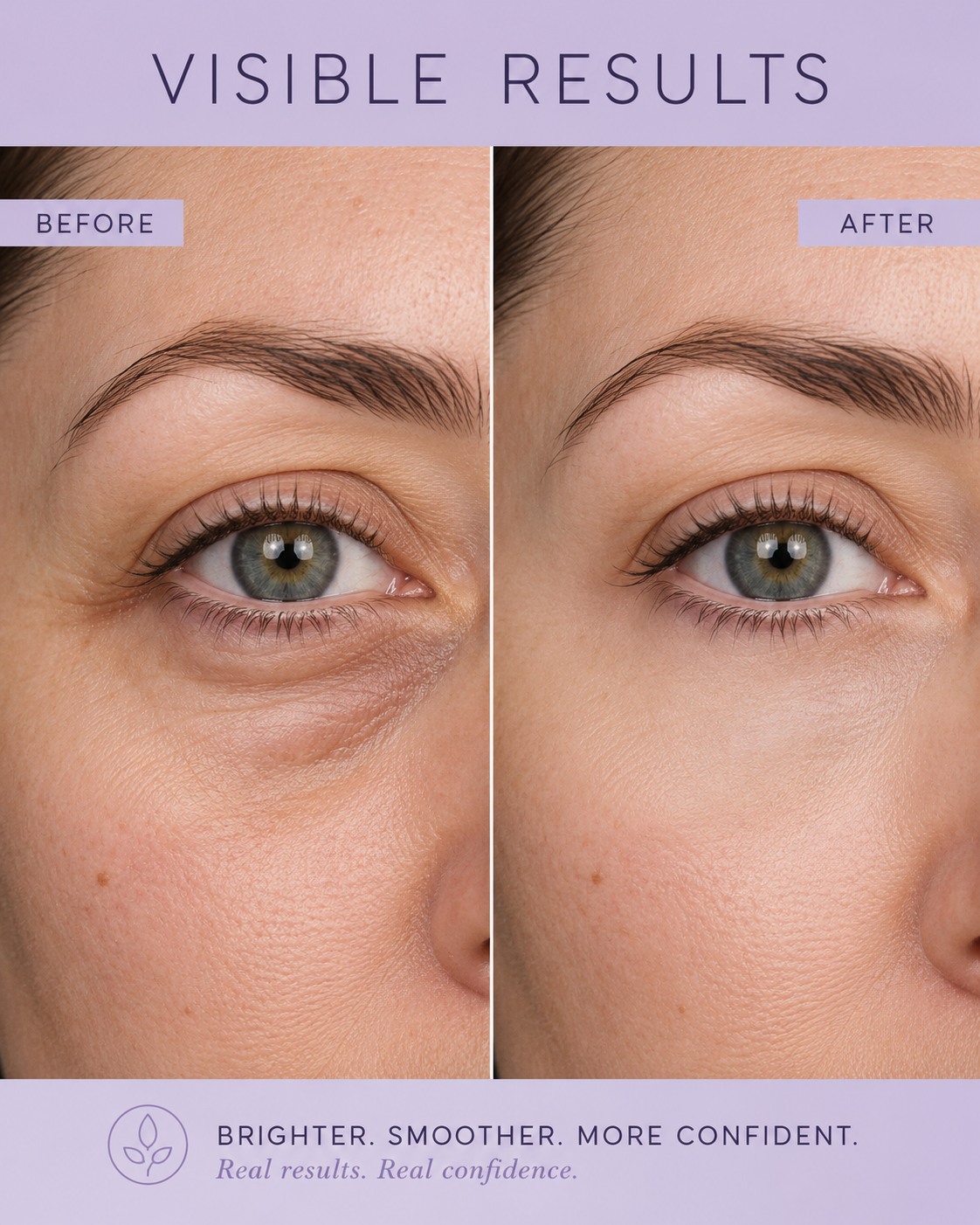 Before and after results